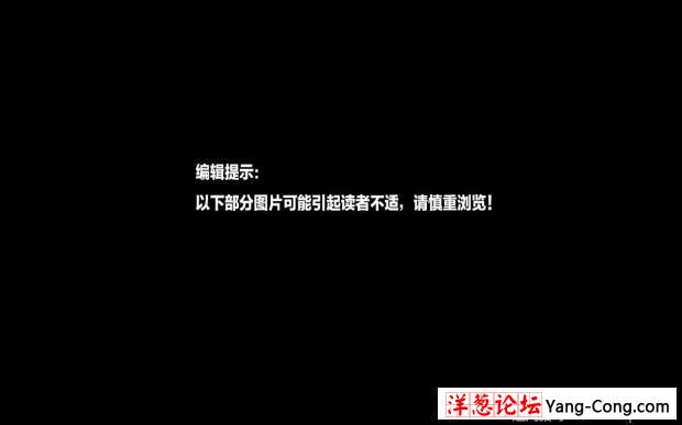 生死“器”约：近距离感受器官移植现场(6)