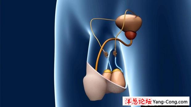 德国木匠发明“精子开关” 不用结扎(3)