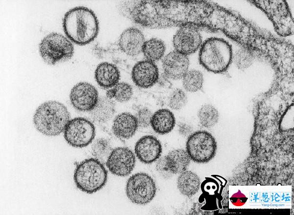 地球上九种最致命的病毒：狂犬病毒100%致死率(4)