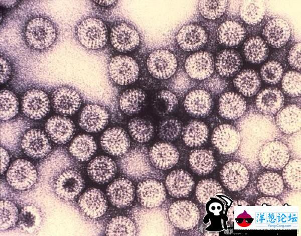 地球上九种最致命的病毒：狂犬病毒100%致死率(1)