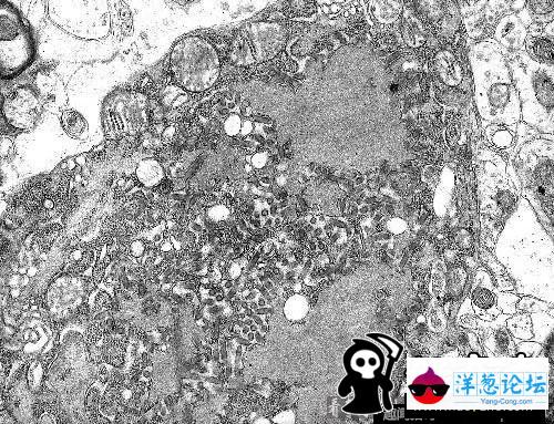 地球上九种最致命的病毒：狂犬病毒100%致死率(7)