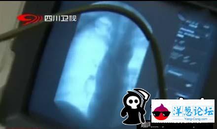 奇葩酒驾男被查吞2枚钻戒：一瓶啤酒算什么酒后(3)