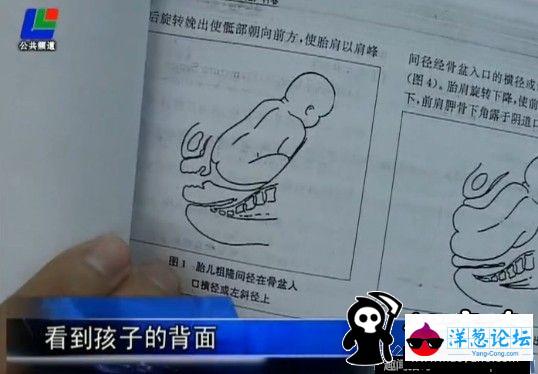 湖北一孕妇产检做7次B超没查出孩子缺脚(4)