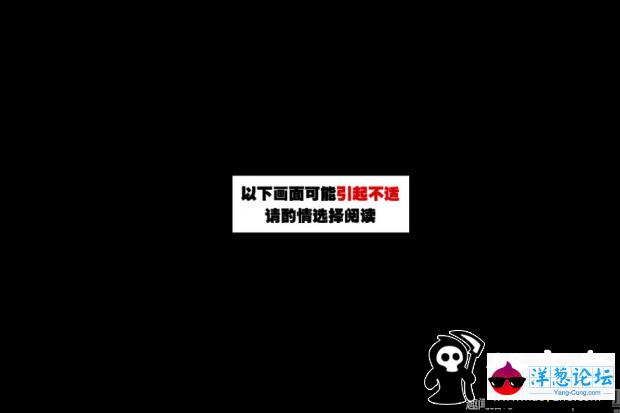 贵州一疯狗咬伤20多人 8岁女孩半张脸被咬破(5)