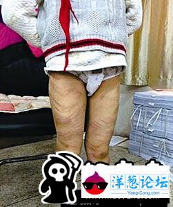 南京虐童案受害男童及父母状告发帖人已获立案(2)